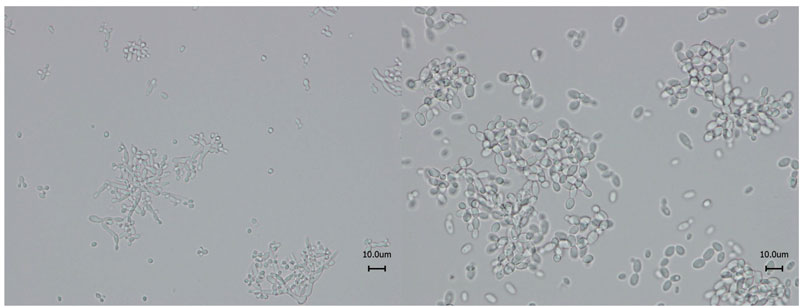 Weingärung: Potenzial von Candida-Hefen