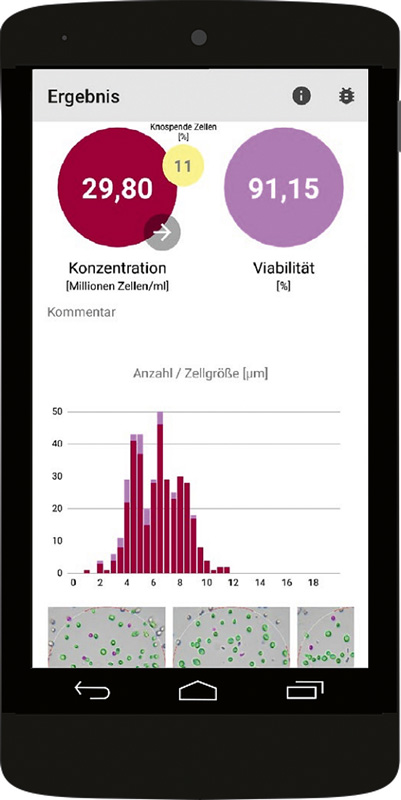 Oculyze im Praxistest